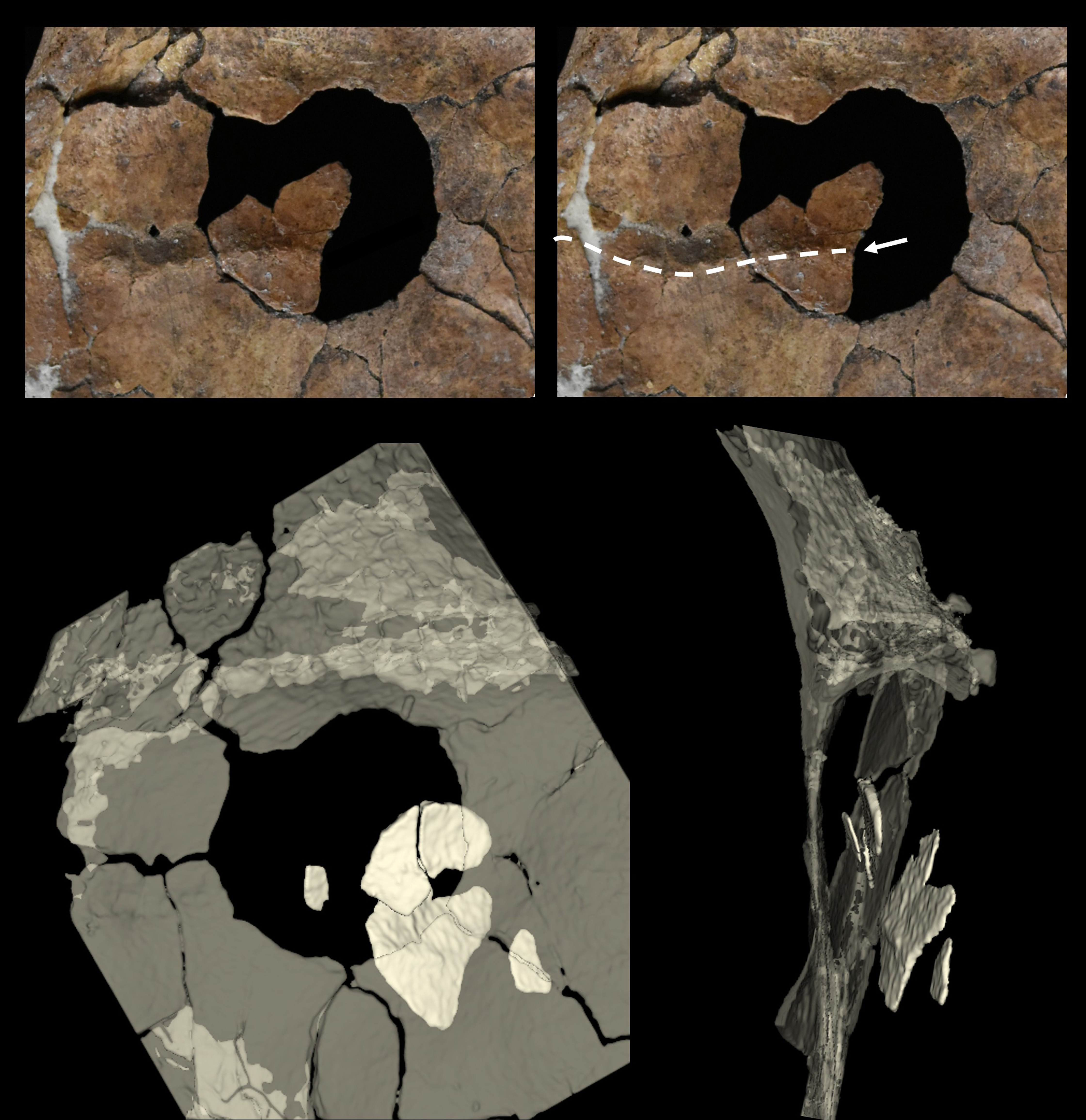 Top, the hole partially filled in with a fragment found below, indicating the direction of the spear's path.(bottom) 3D rendering of the hole and fragments embedded in the sediment underneath the scapula in situ prior to conservation. Top, the hole partially filled in with a fragment found below, indicating the direction of the spear's path.(bottom) 3D rendering of the hole and fragments embedded in the sediment underneath the scapula in situ prior to conservation.